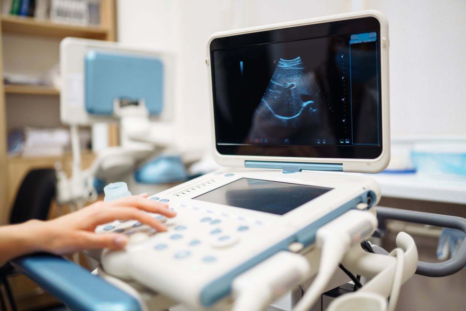 Ultrasound machine